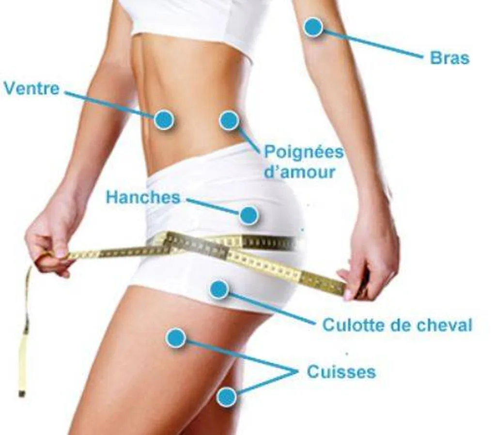Zones pour traitement Lipocavitation