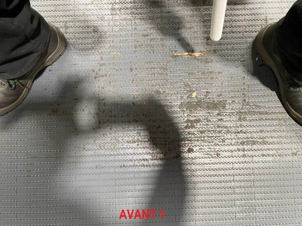 AVANT INTERVENTION 1