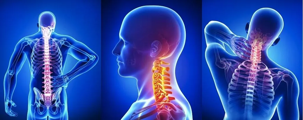 Soulager vos douleurs lombaires  Paris 75