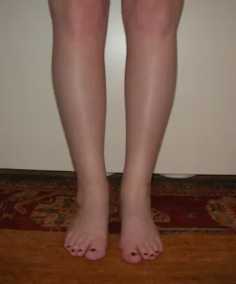 Calf and ankle liposuction in France: Dr Jean-François Pascal’s expertise in Lyon