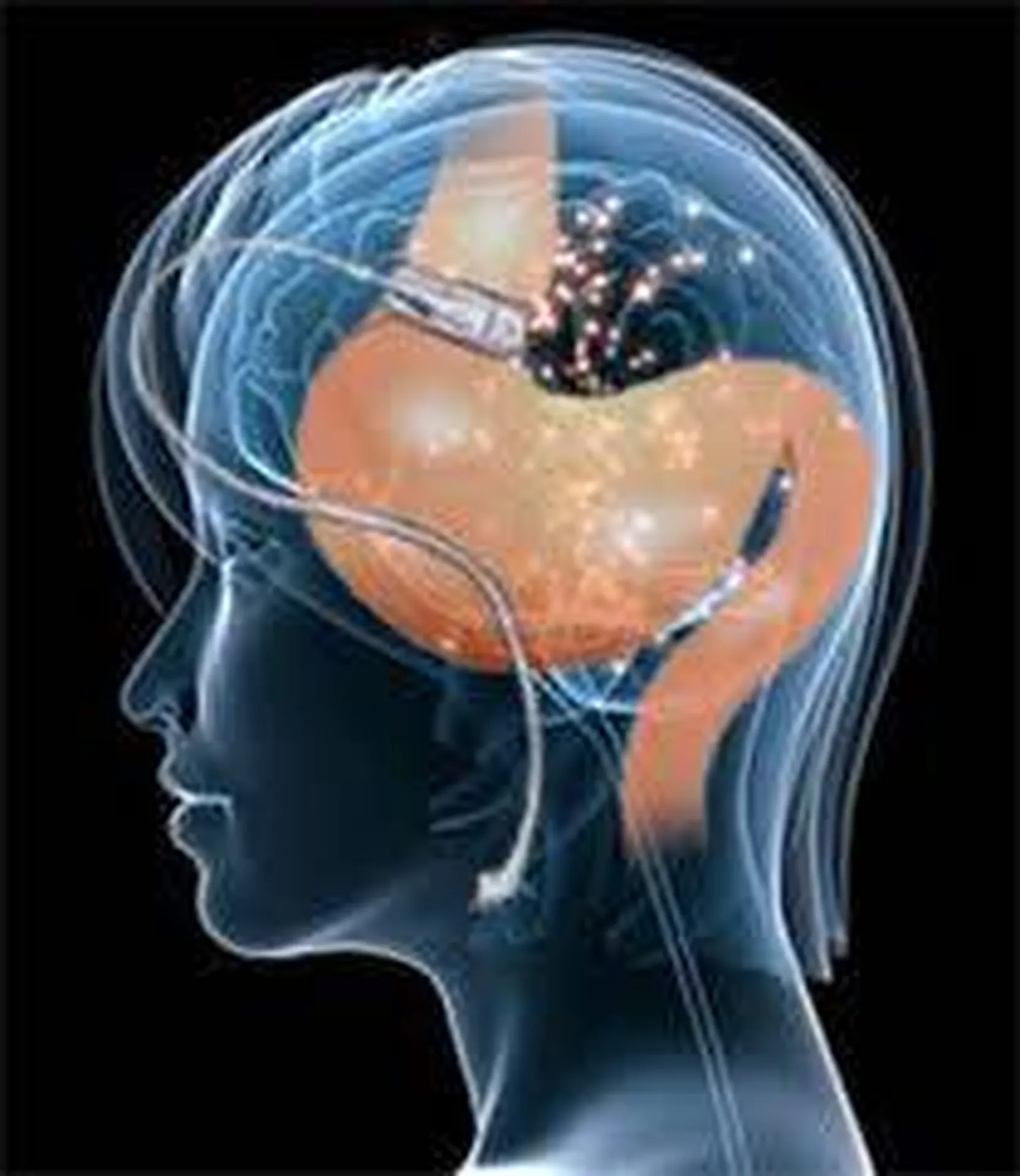 Dubai treatment of obesity Hyeres