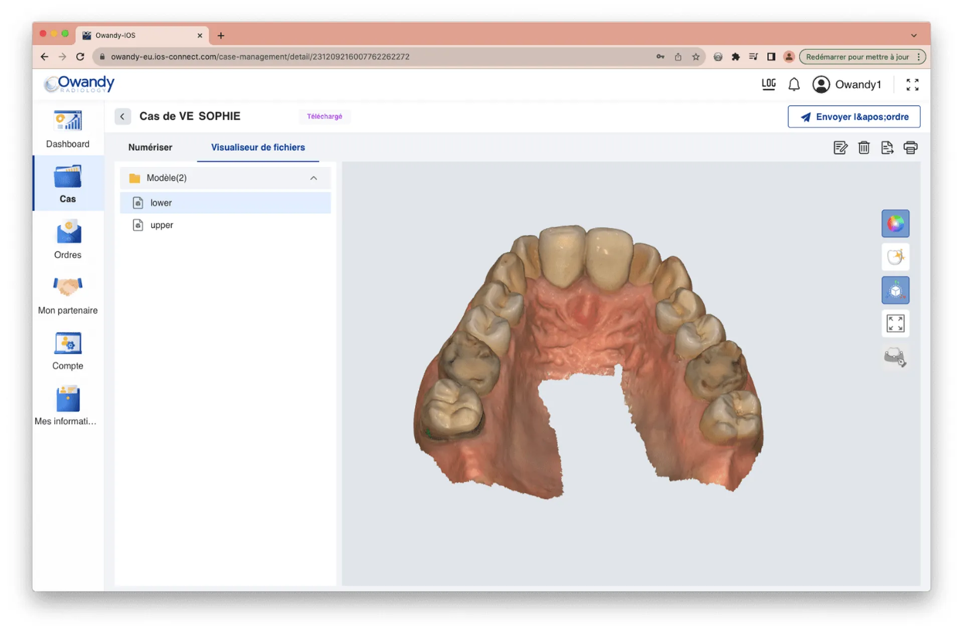 Owandy IOS scanner intra oral, une solution 3D rapide, précise et ergonomique pour moderniser les prises d'empreintes à Aix en Provence