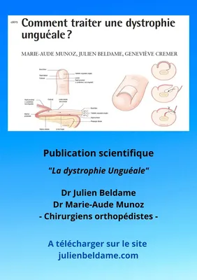 La dystrophie unguéale, publication scientifique des docteurs Julien Beldame et Marie-Aude Munoz, chirurgiens orthopédistes