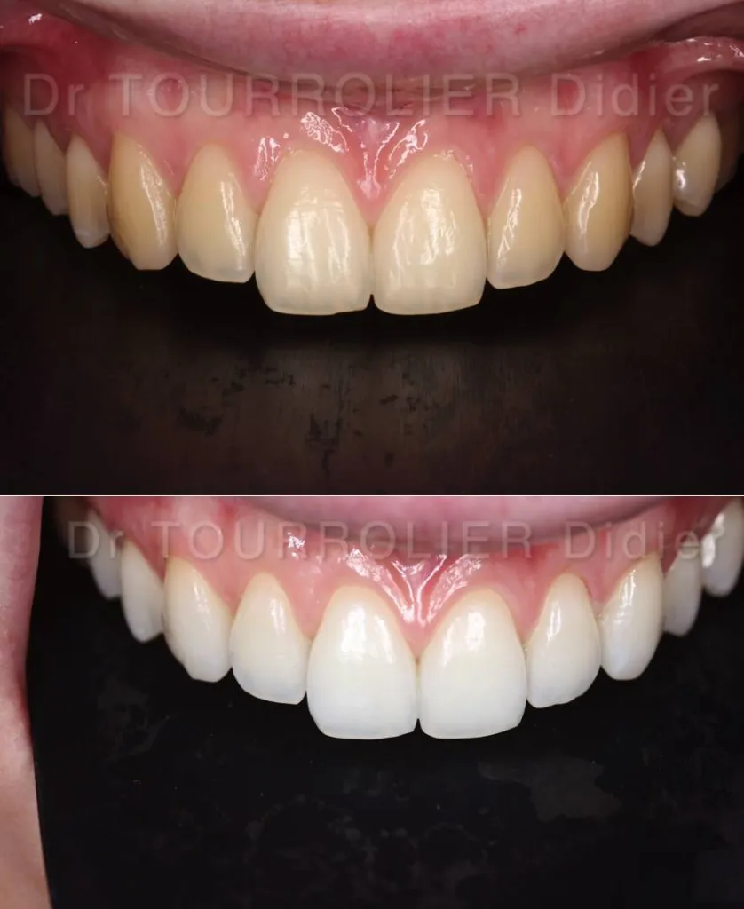 spécialmiste en dentsiterie esthétique sur Marseille