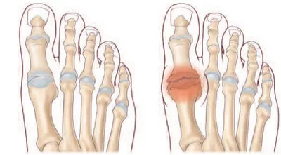 Docteur Julien Beldame, chirurgien orthopédiste, exclusif Pied Cheville, Fondateur de l'Institut de la Cheville et du Pied à Amiens (ICP Amiens), consulte à l'ICP Paris