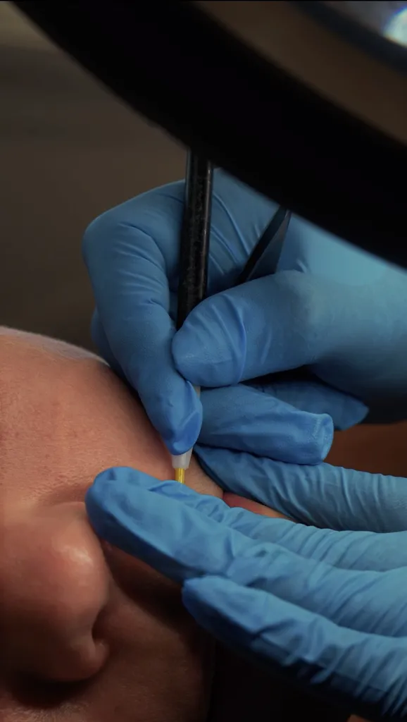 Thermolyse Apilus Mage Studio