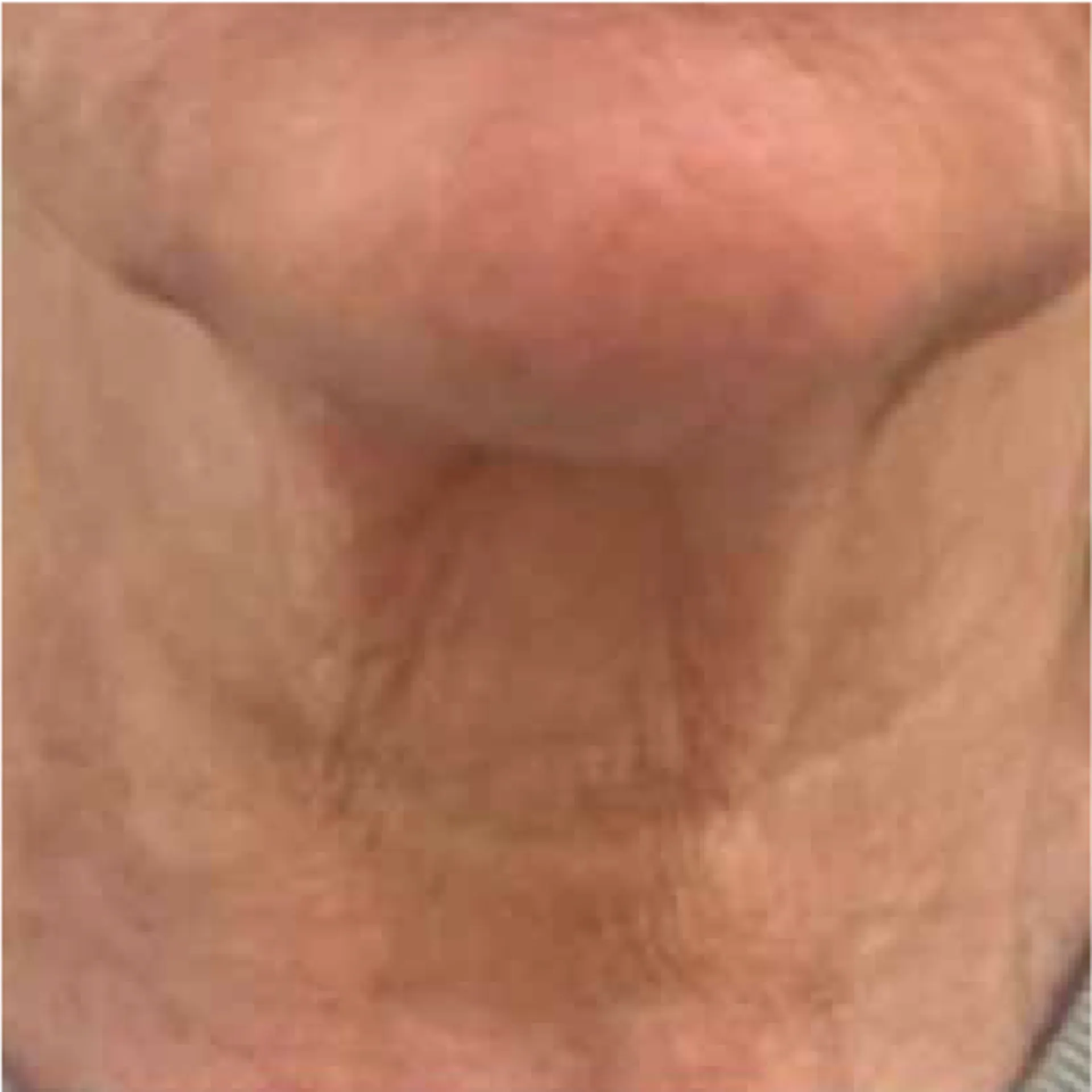 Lifting du cou sans chirurgie à Aix-en-Provence