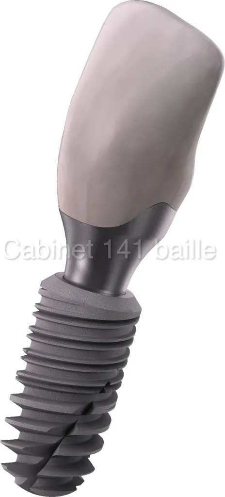 Quel est le PRIX d'un implant .Dr TOURROLIER DiIDER .13005