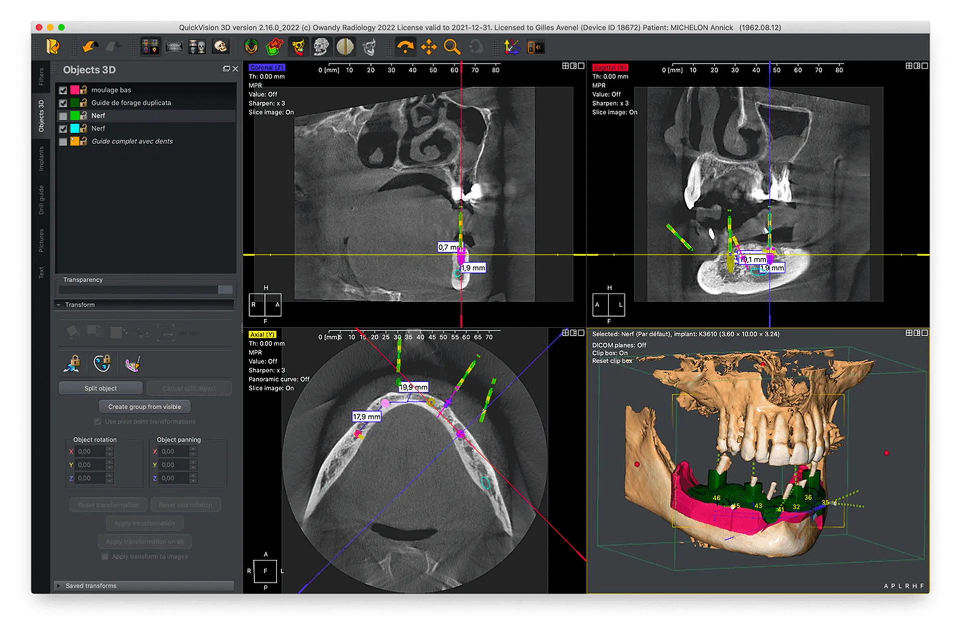 Owandy Quickvision 3D Meditec Dental à Aix en Provence 13
