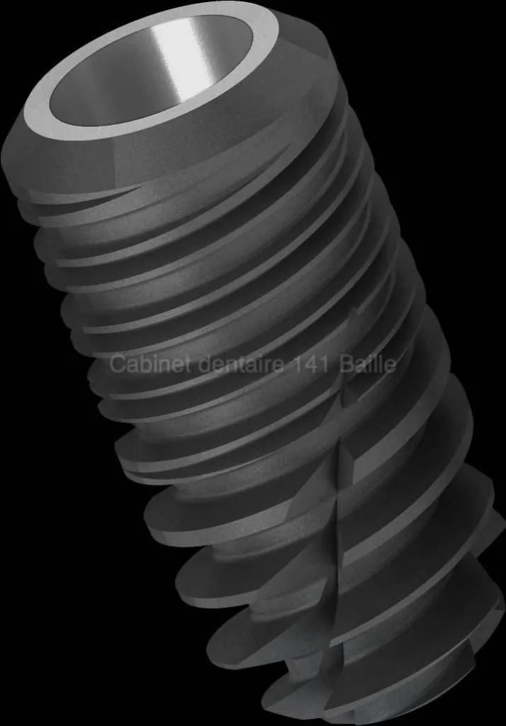 Implant pour remplacer une dent infectée.Cabinet 141 Baille 13005 Marseille.