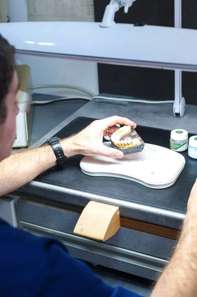 Spécialiste facette dentaire céramique TOULON