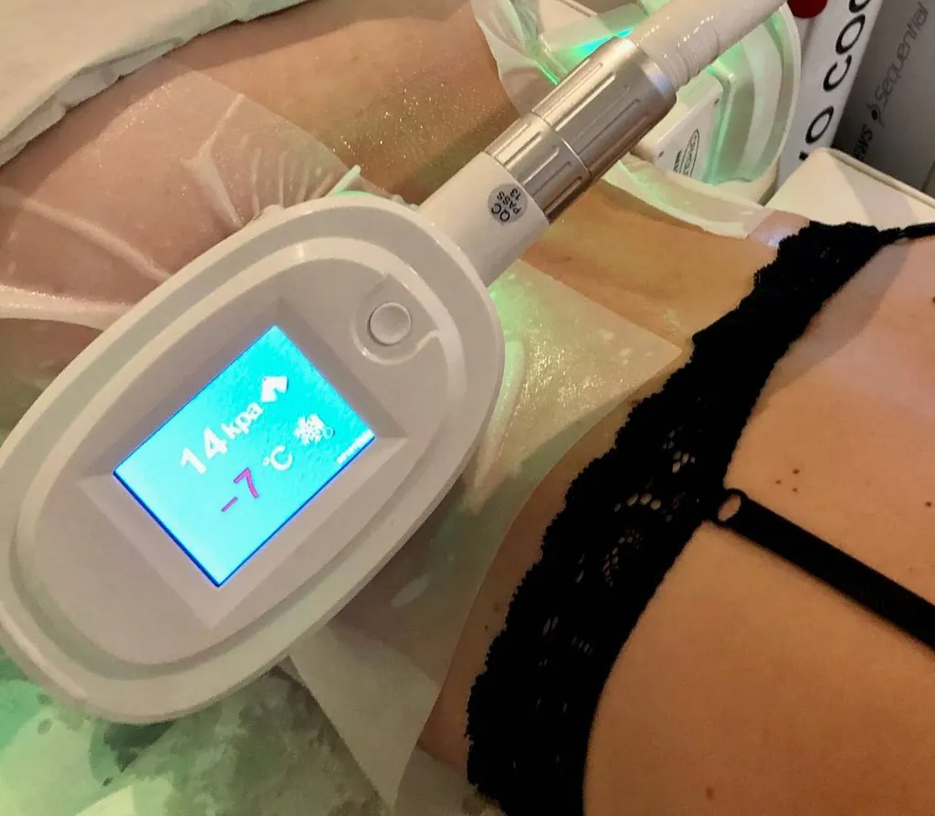 Soin minceur cryolipolyse 2 séances achetées 1 offerte Anadrea hyères