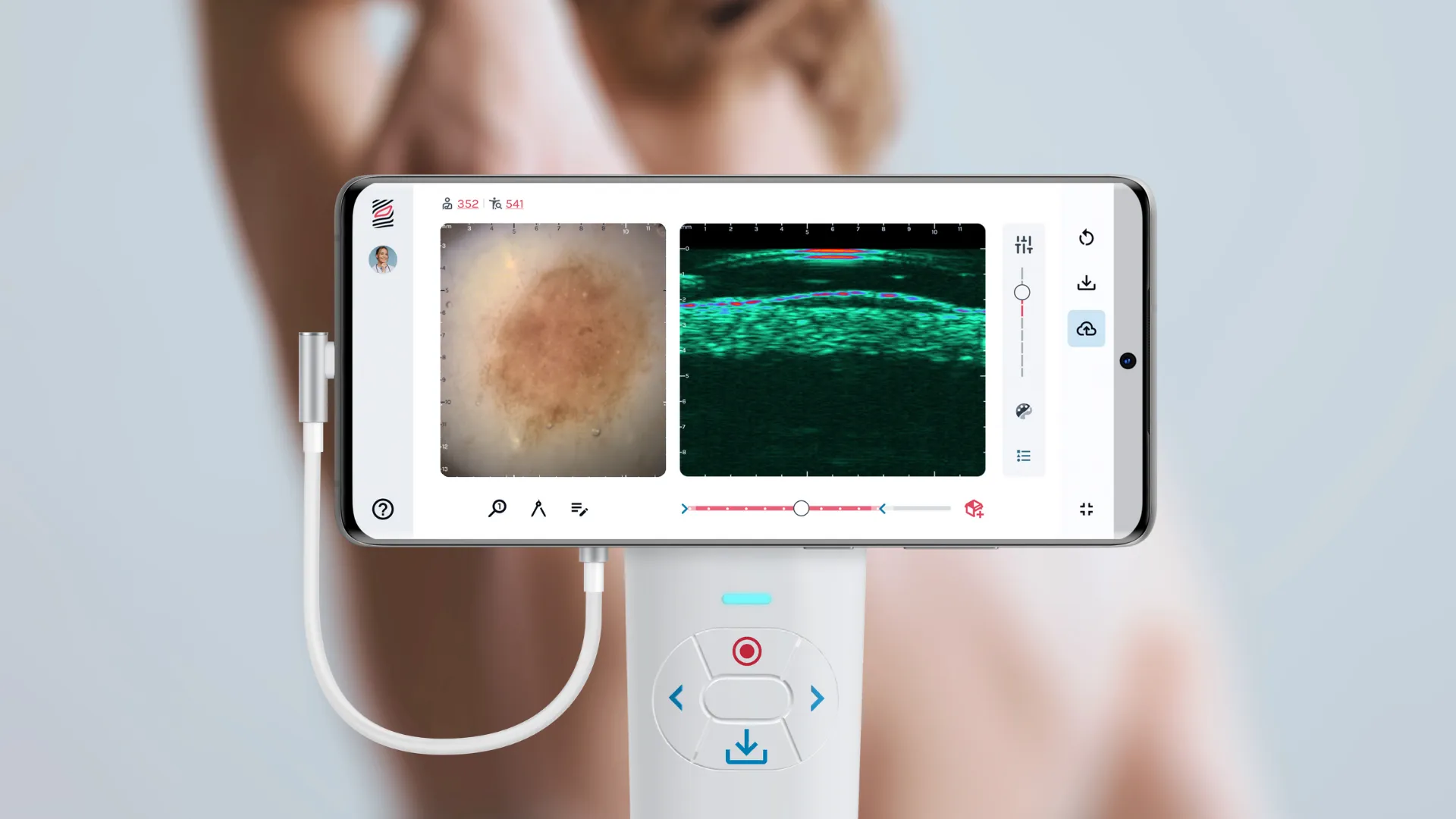 Centre DermAlert : expert du dépistage des lésions cutanées à  Marseille, Carry-le-Rouet, et Aix en Provence