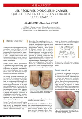 Publication du Dr Julien Beldame, récidive d'ongle incarné
