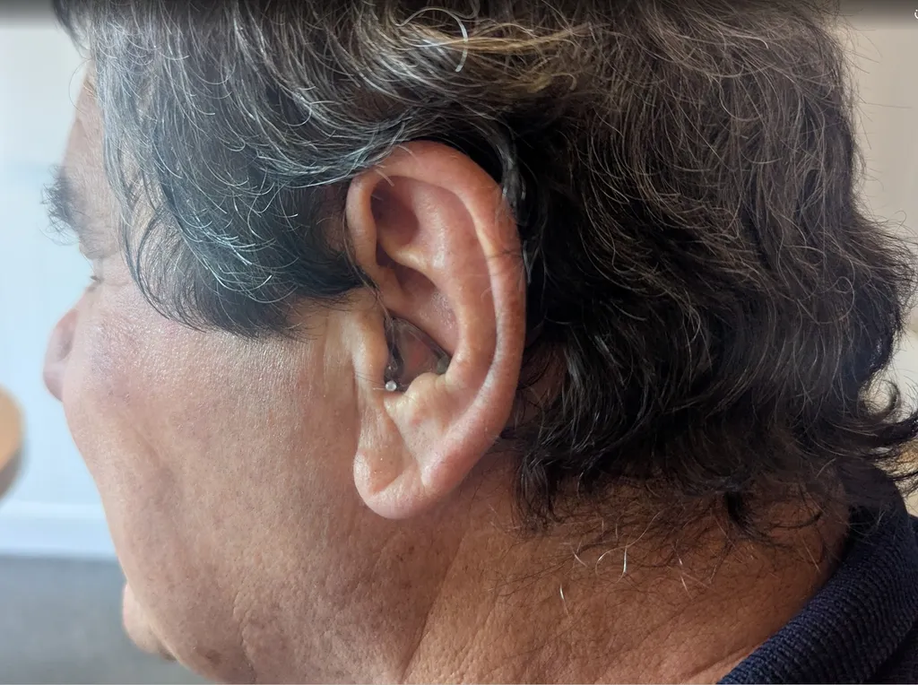 Embout de protection sur mesure