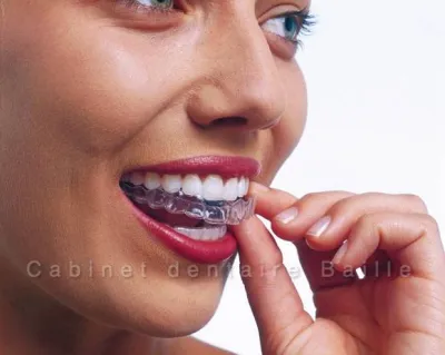 Invisalign Toulon avis.  Cabinet 141 Baille 13005 Marseille.Dr Tourrolier didier.