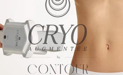 Cryolipolise avec IA