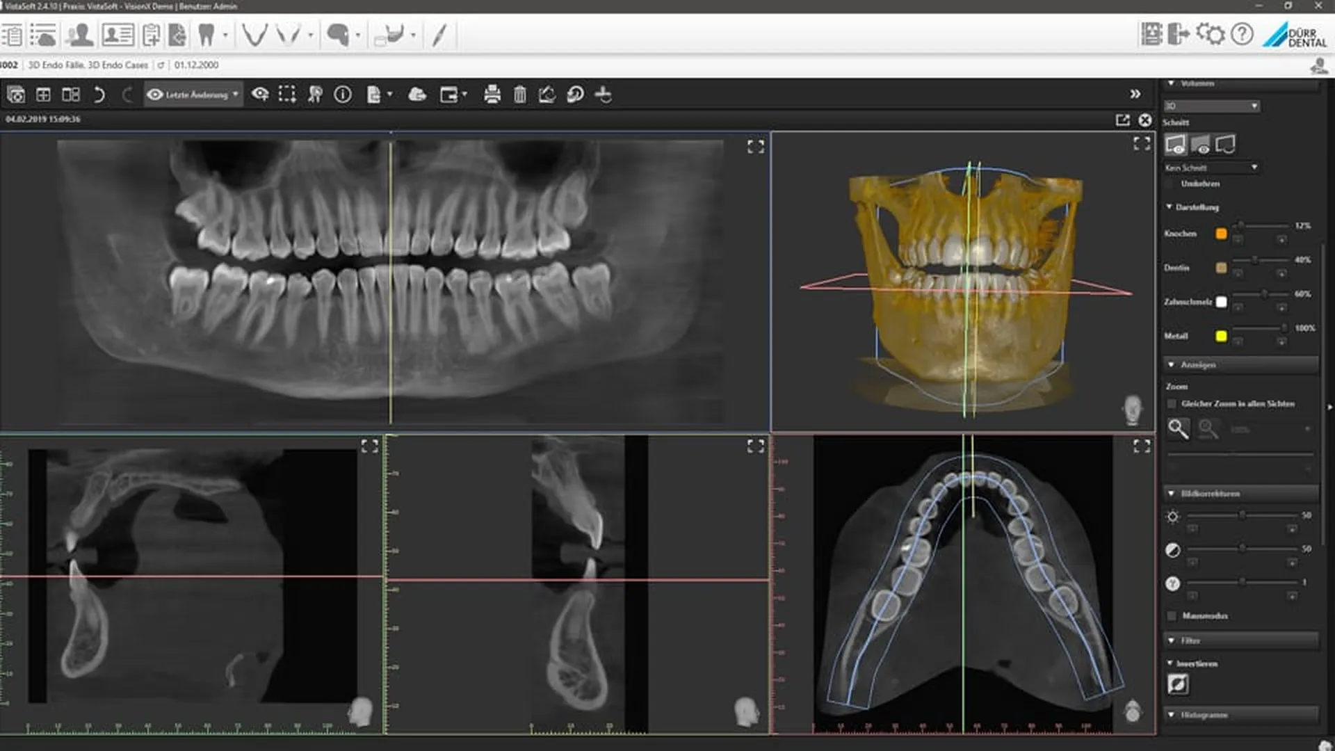 Installation panoramique dentaire 2D, 3D / CBCT Owandy IMax et Durr Dental VistaVox pour équiper votre cabinet dentaire à Menton Alpes Maritimes 06
