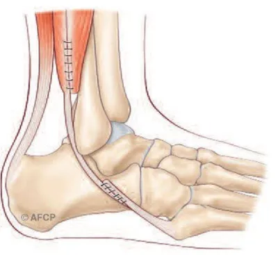 Docteur Julien Beldame, chirurgien orthopédiste, exclusif Pied Cheville, Fondateur de l'Institut de la Cheville et du Pied à Amiens (ICP Amiens), consulte à l'ICP Paris