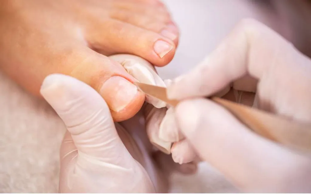 Pédicure professionnelle pour mise en beauté des ongles des pieds avec soin des cuticules et finition nette pour des pieds élégants et soignés à Pessac
