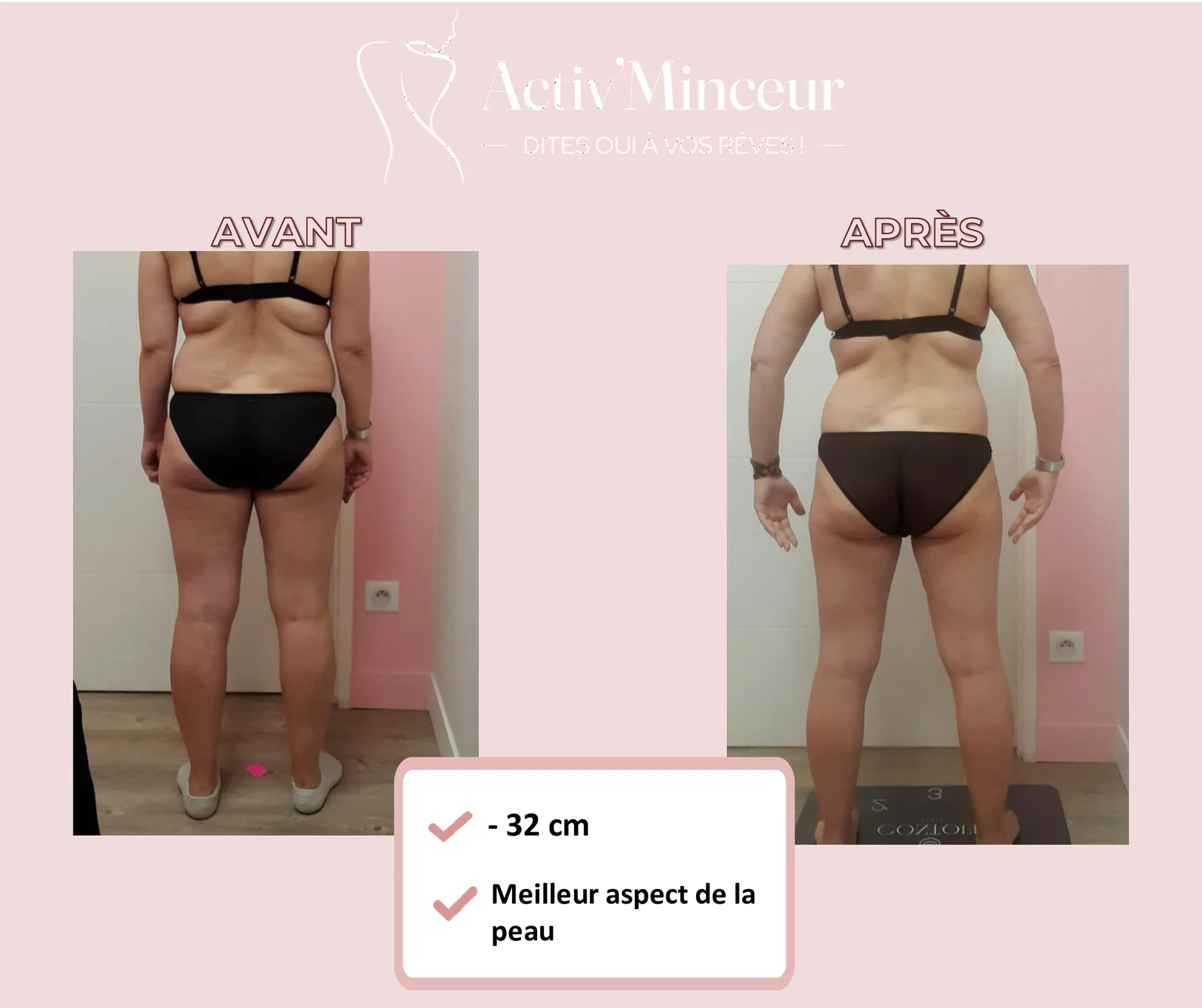 Découvrez la transformation spectaculaire de Carole : -32 cm de tour de taille à 50 ans chez Activ'Minceur