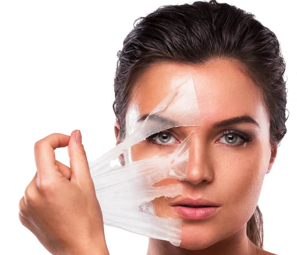 peeling qualité de peau profhilo melasma