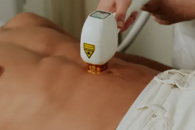 Centre spécialisée dans l'épilation laser définitive pour hommes, épilation intégrale dos et torse proche de Toulouse en Haute Garonne