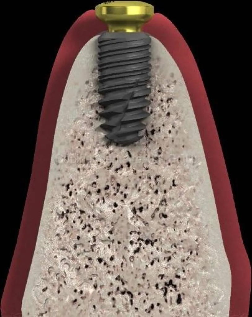 Notre zone d'activité pour ce serviceDentiste pour pose d'implant Nobel