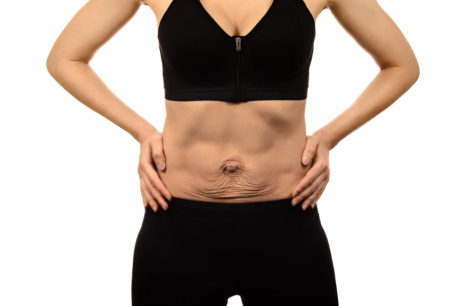 J’ai perdu beaucoup de kilos : au centre expert esthétique DERMA SUD Castanet-Tolosan, raffermir ventre, bras et cuisses grâce à la radiofréquence INDIBA® après une perte de poids