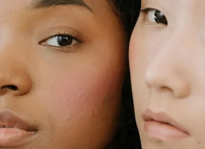 Soin visage ado et préado à toulouse 