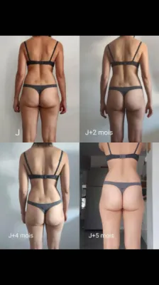 peau lisse cellulite coach electrostimulation bien être six fours