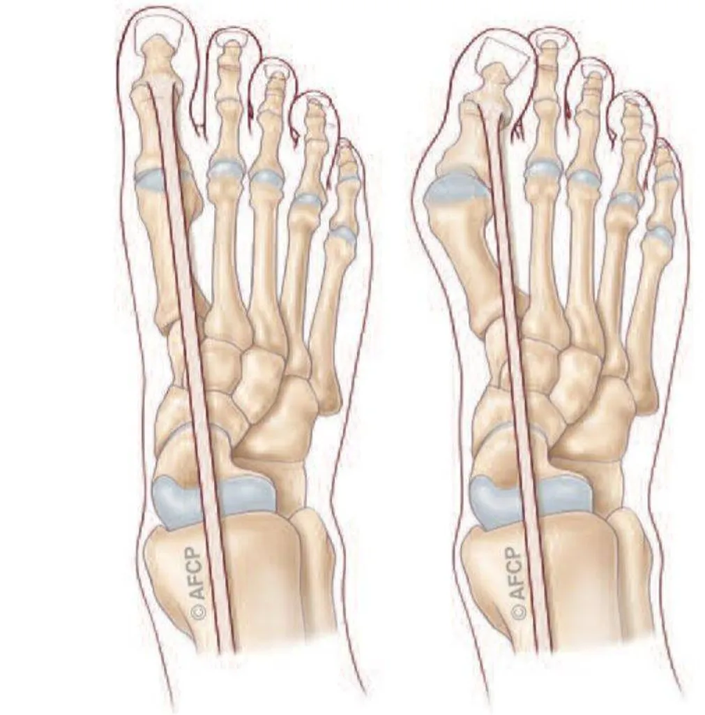 Docteur Julien Beldame, chirurgien orthopédiste, exclusif Pied Cheville, Fondateur de l'Institut de la Cheville et du Pied à Amiens (ICP amiens), consulte à l'ICP Paris