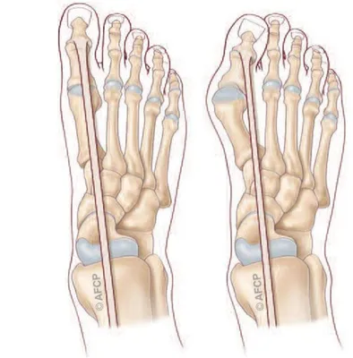 Docteur Julien Beldame, chirurgien orthopédiste, exclusif Pied Cheville, Fondateur de l'Institut de la Cheville et du Pied à Amiens (ICP amiens), consulte à l'ICP Paris
