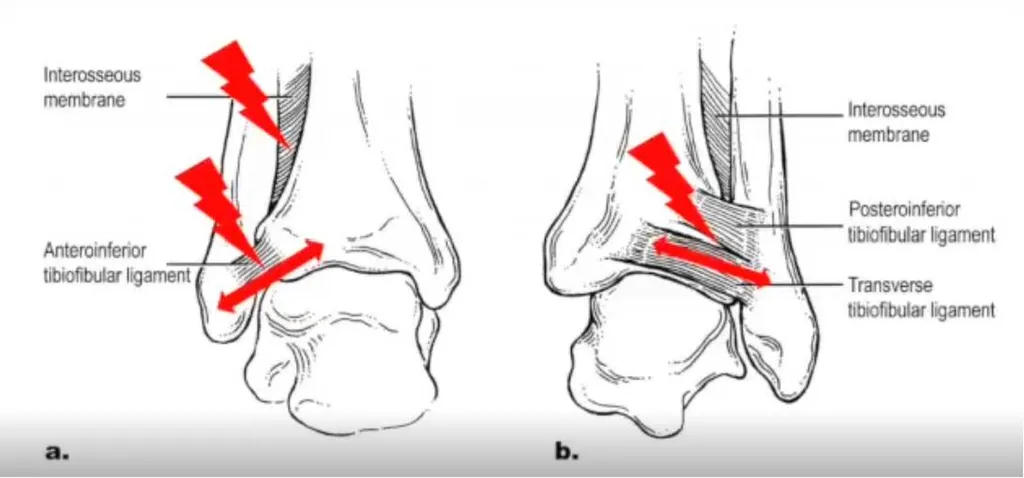 Dr Julien Beldame, chirurgien orthopédiste et traumatologue