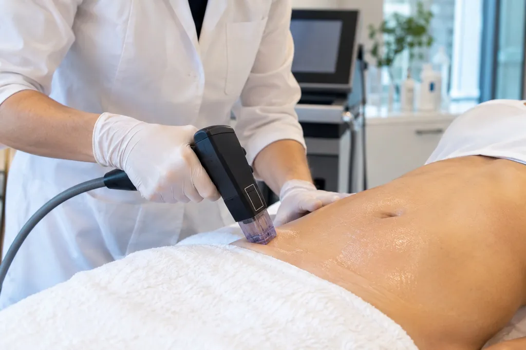 Morpheus8 à Aix-en-Provence : raffermir la peau sans chirurgie