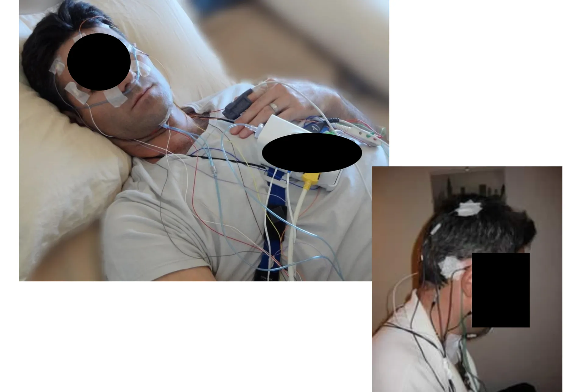 polysomnographie trouble du sommeil draguignan