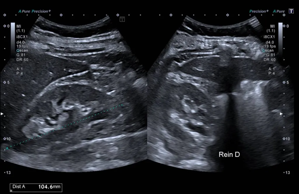 Notre zone d'activité pour ce servicePasser une échographie de la thyroïde