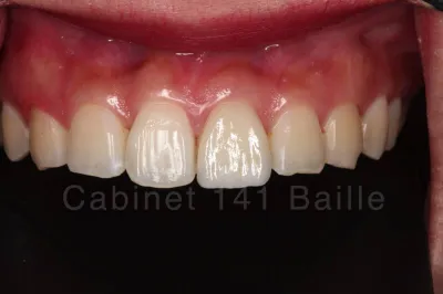 cabinet spécialisé en restaurations estéhtqiues en céramiques