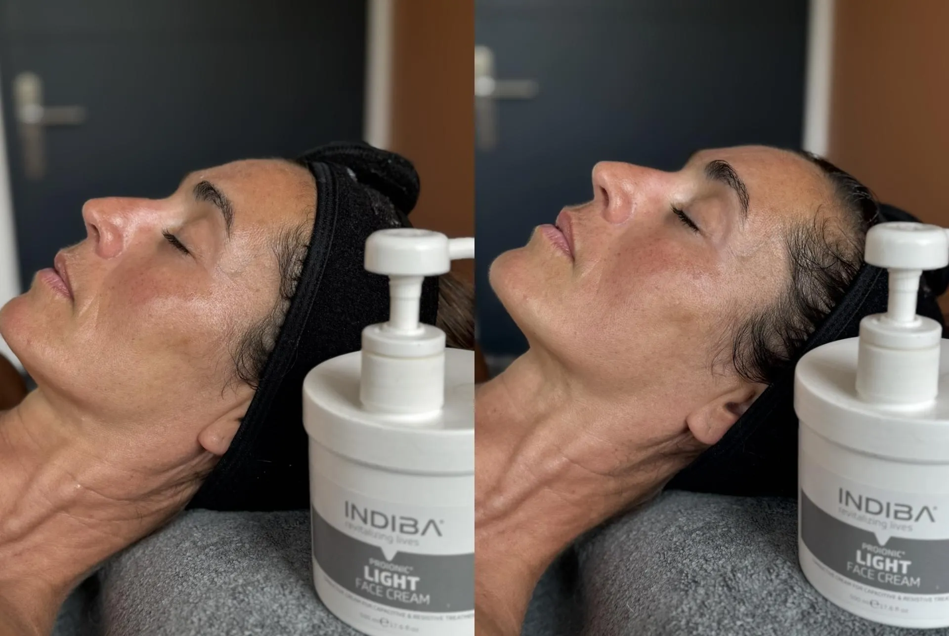 Soin INDIBA visage à Toulouse chez MAGE STUDIO