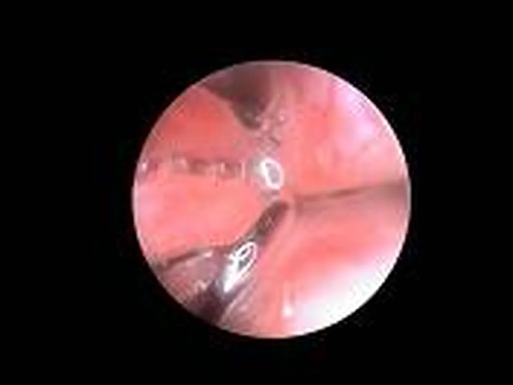 rhinoscopie chien Toulon