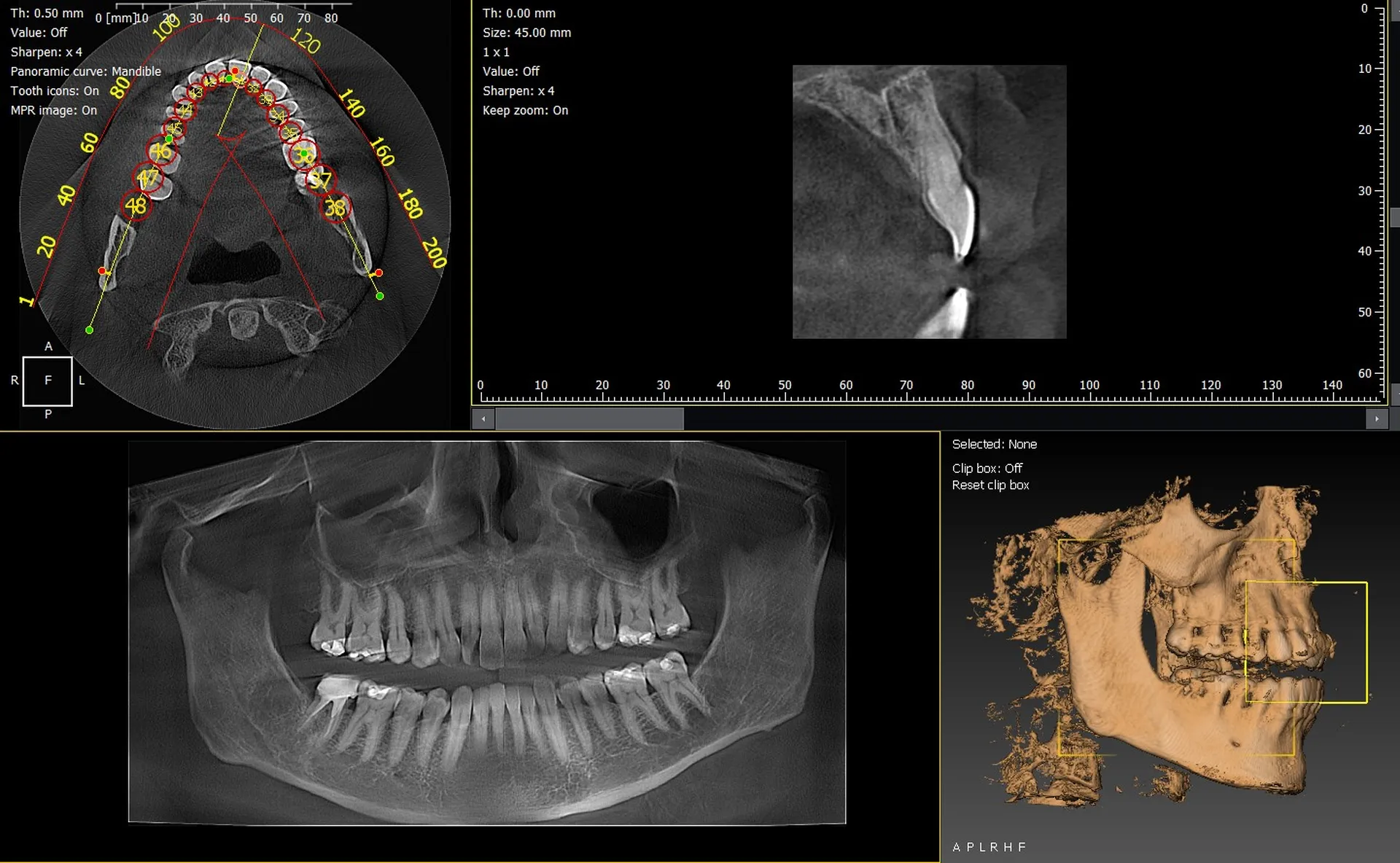 Panoramique dentaire 2D, 3D / CBCT Owandy IMax et Durr Dental VistaVox pour équiper votre cabinet dentaire à Embrun Hautes Alpes 05
