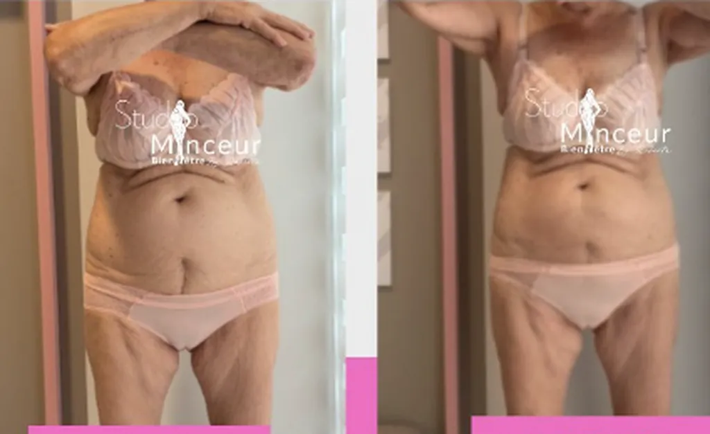 L'intelligence artificielle ajuste automatiquement les paramètres pour une efficacité optimale