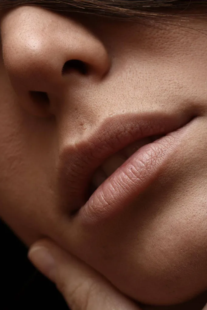 réhydrater ses lèvres, traitement des rides du contour buccal, augmenter le volume de ses lèvres, redessiner le contour par les injections d'acide hyaluronique sur le bassin d'arcachon à gujan mestras proche de la teste de buch, de Mios, de parentis en bo