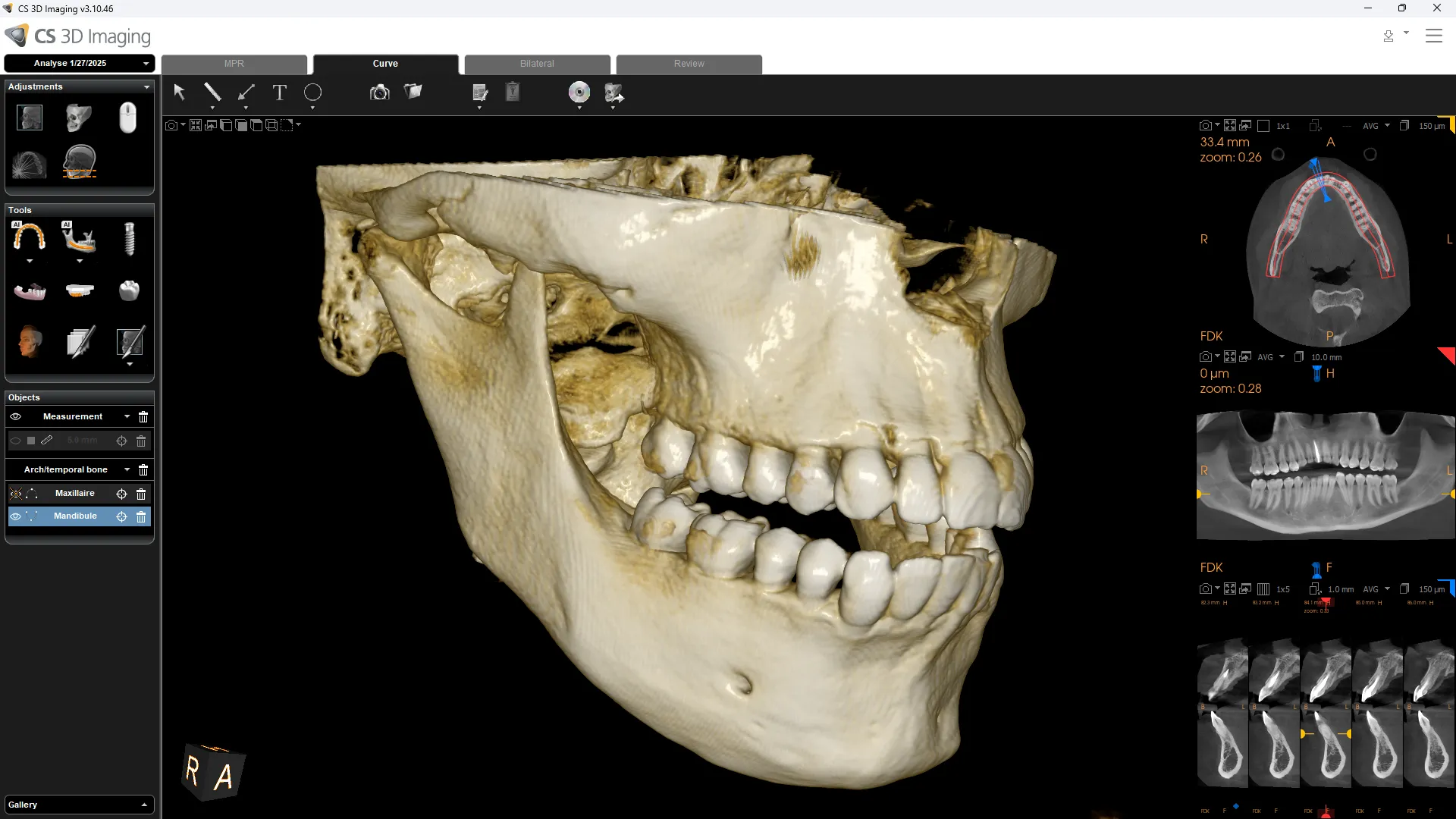 Carestream Dental CS8200 3D