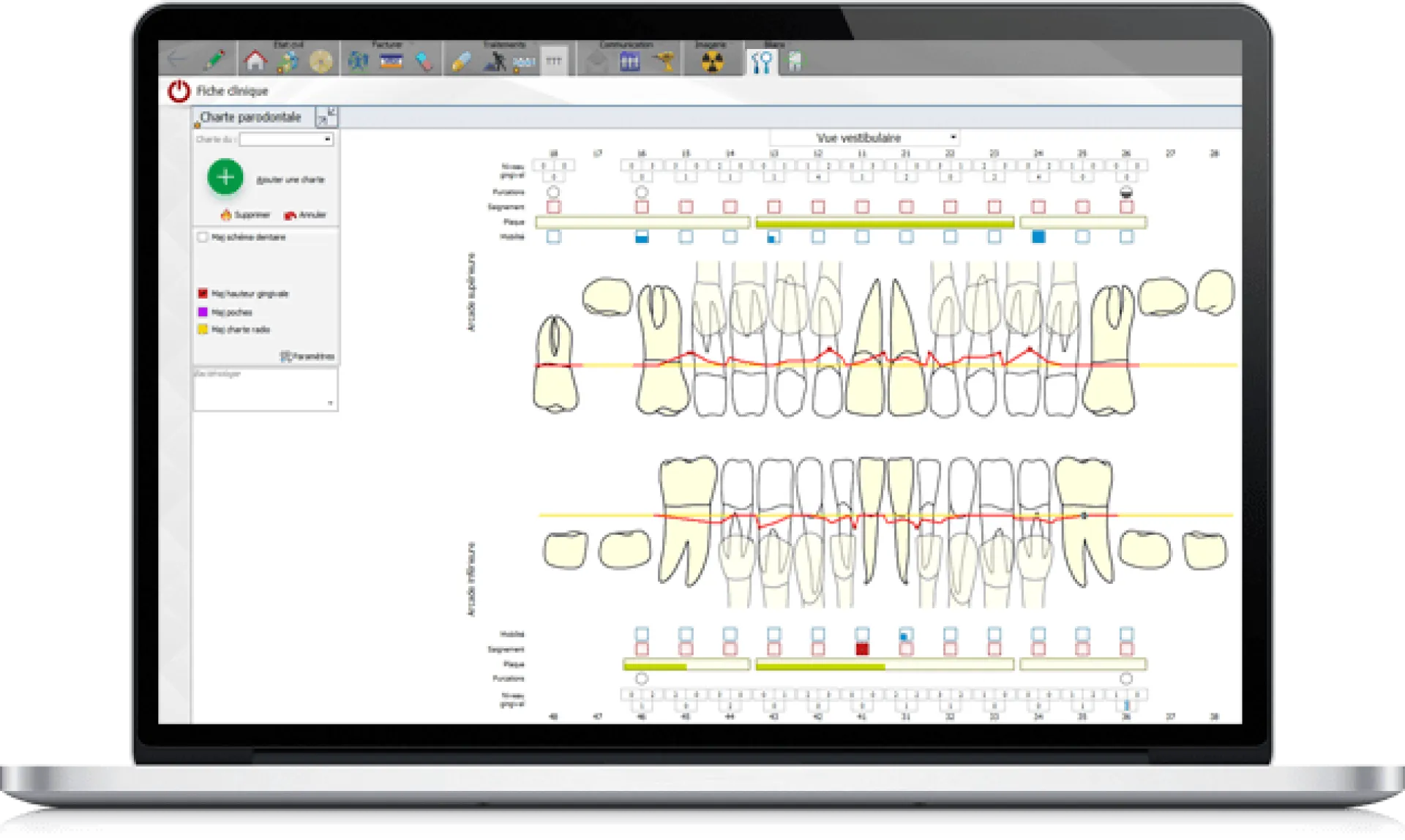Formation à l'utilisation de LOGOSw  Meditec Dental à Toulon 83
