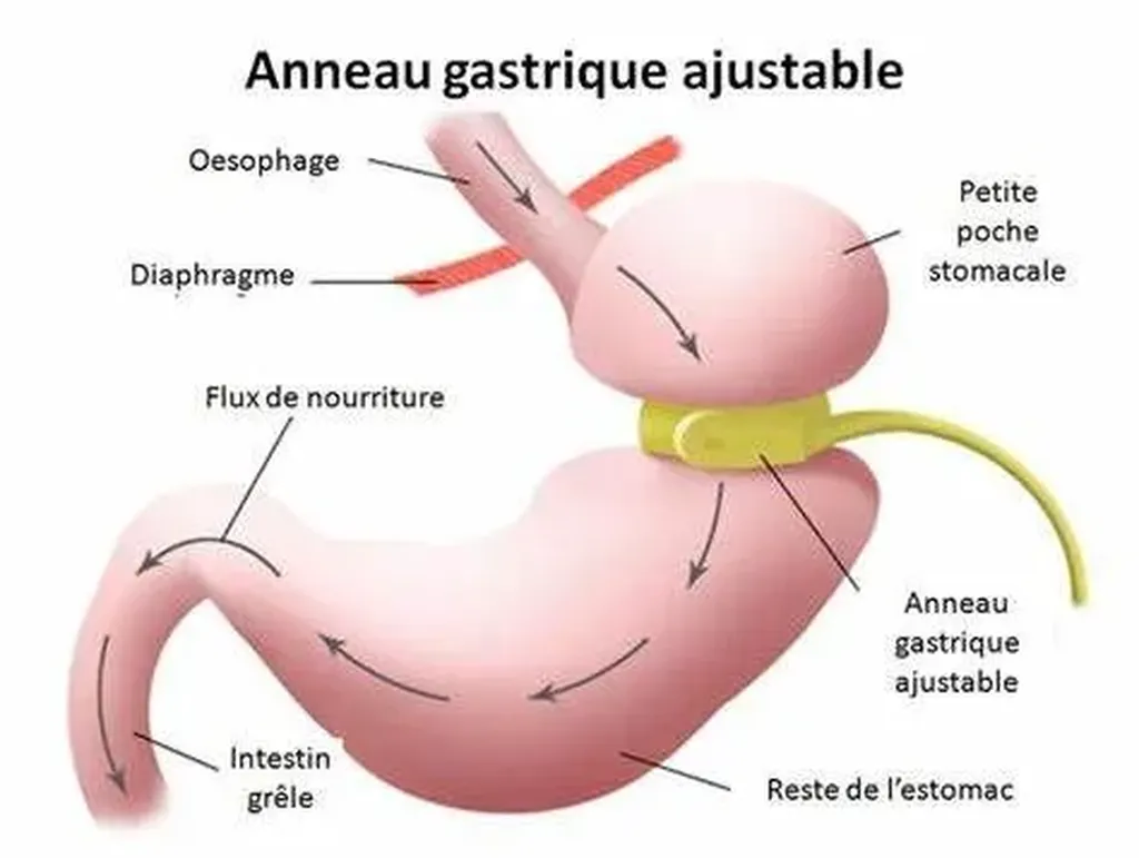 ATELIER : L’HYPNOSE AU COEUR DE L’ASSIETTE