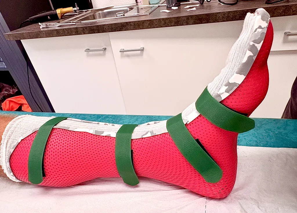 Botte de marche suropedieuse pour immobilisation du membre inférieur suite à une fracture sur le péroné à Toulon  dans le Var 