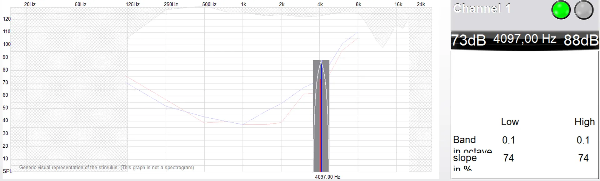 Mesure des acouphènes