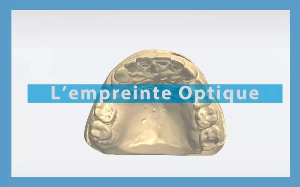 Empreinte optique 