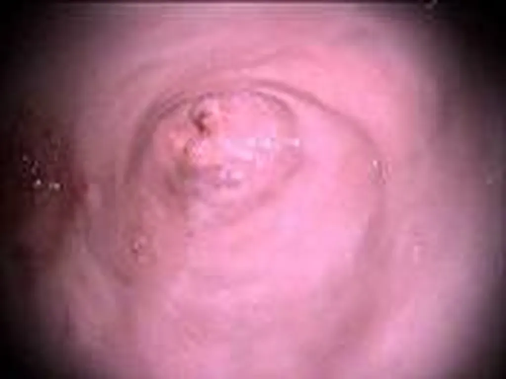 endoscopie agglomération Toulonnaise